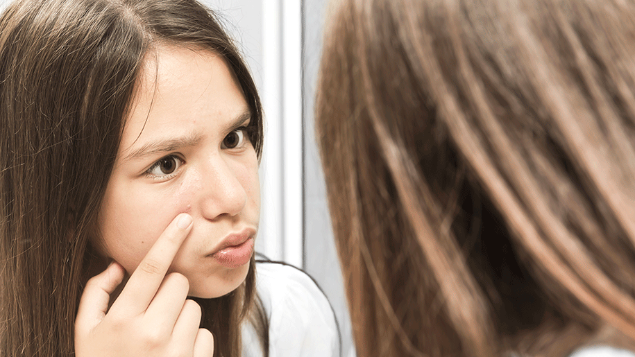 Girl looking in a mirror with her finger in a pimple