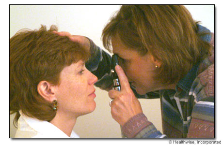 Direct ophthalmoscopic exam