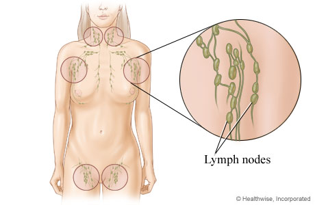 Lymph nodes and their locations in the body