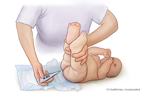 Taking a rectal temperature of a baby