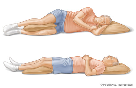 Picture of sleeping positions for people who have low back pain