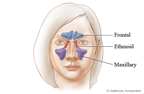 Where facial sinus cavities are located (front view)