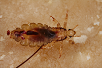 A singe louse