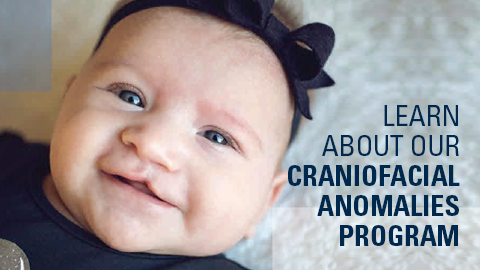Baby with a cleft lip