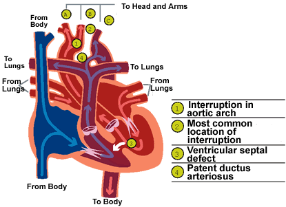 Aorta Heart Branches